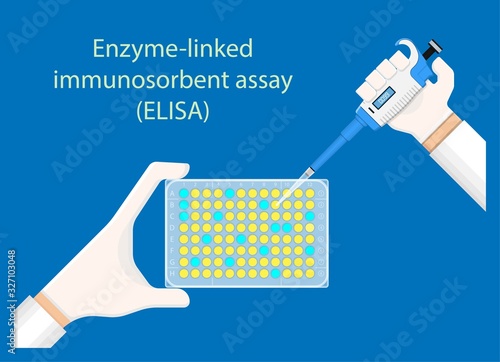Enzyme linked immunosorbent assay ELISA Immunoassay EIA antibodies infectious technician analyze