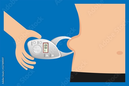 Fat measurement equipment adipometro monitoring overweight determining percent body calculate fat body composition method losing weight sport science human skin fold result subcutaneous healthy waist