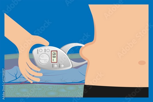 Fat measurement equipment adipometro monitoring overweight determining percent body calculate fat body composition method losing weight sport science human skin fold result subcutaneous healthy waist