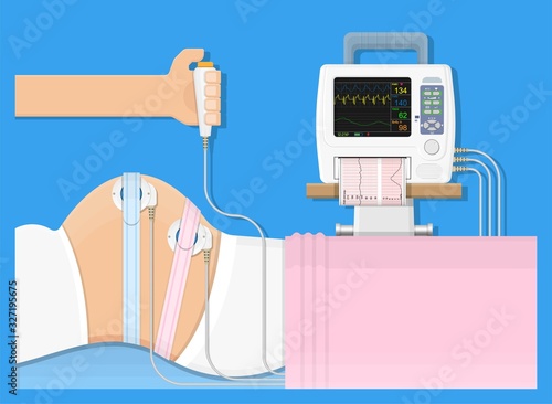 fetal monitor FHR exam signal sensor room beat labor CTG graph baby toco cervix woman female treat fetus womb women clinic doctor mother labour midwife screen measure uterus device clinical external