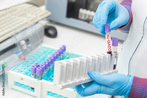 doctor hand taking a blood sample tube from a rack with machines of analysis in the lab background / Technician holding blood tube with coronavirus positive sample in the research laboratory