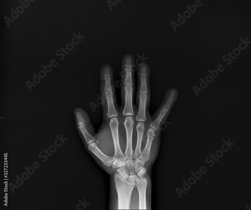 x- ray of the wrist joint
