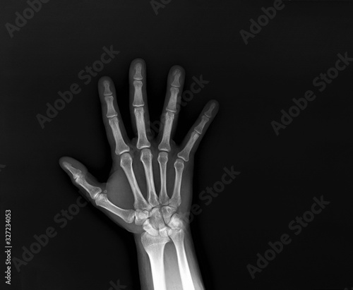 x-ray of the hand and wrist bones