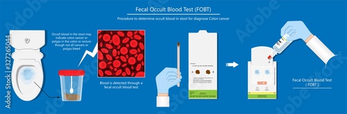 Fecal occult blood test FOBT lab stool sample bleeding screen risk examination collect container Guaiac diagnosis sign hemoccult smear FIT diagnostic