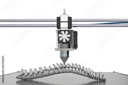 3d printer print prosthetic spine