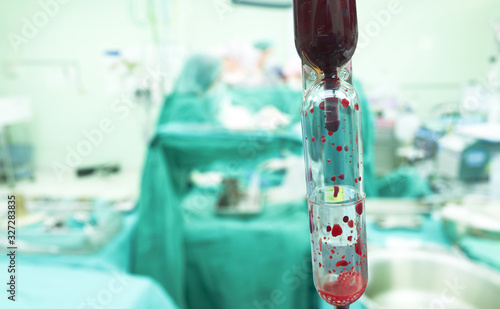 Blood transfusion to patients undergoing surgery photo