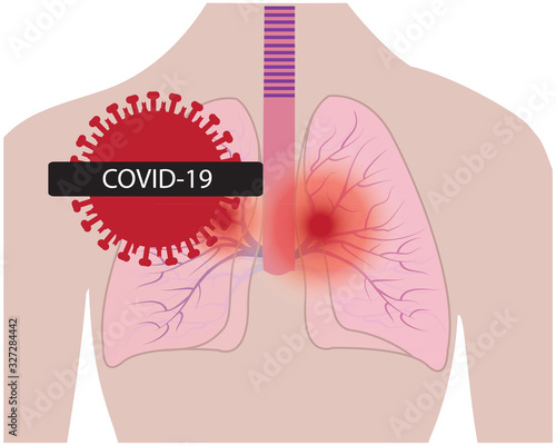 Lungs affected with coronavirus infection COVID19 vector illustration isolated on a white background