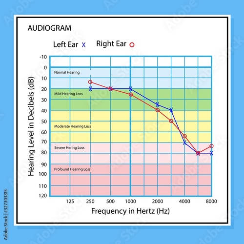 Audiologist audiometry hearing test screening
