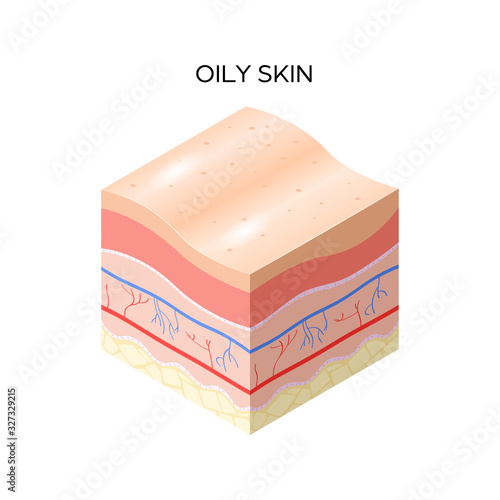 oily skin cross-section of human skin layers structure skincare medical concept flat vector illustration