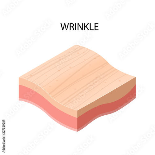 wrinkle formation cross-section of human skin layers structure skincare medical concept flat vector illustration