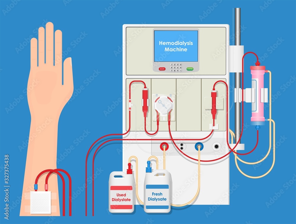Hemodialysis Machine Equipment Procedure Room Kidney Patient Treatment
