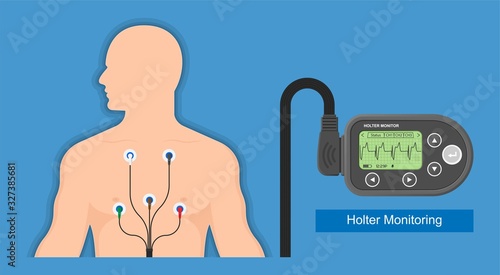 Holter monitoring system tracking cardio problem failure sick irregular disorders transducer therapy cardioversion heartbeat non invasive diagnosis treat