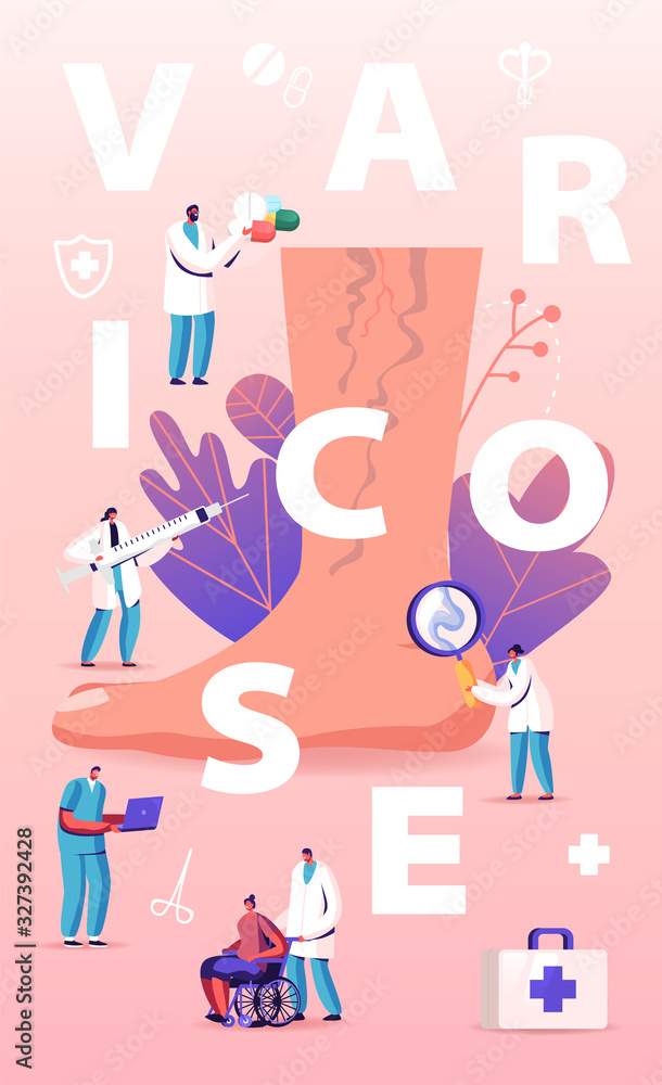 Varicose Treatment Concept. Tiny Doctor Characters with Medical Instruments and Drugs around of Huge Foot with Diseased Veins, Health Care Poster Banner Flyer Brochure Cartoon Flat Vector Illustration Varicose Treatment Concept. Tiny Doctor Characters with Medical Instruments and Drugs around of Huge Foot with Diseased Veins, Health Care Poster Banner Flyer Brochure Cartoon Flat Vector Illustration