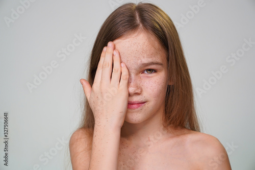 teen girl with freckles red hair covers face hand