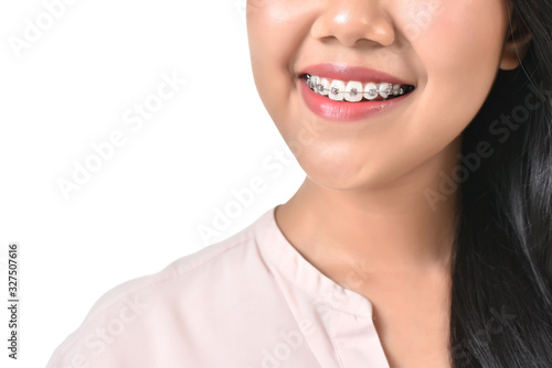 Asian woman were brace are smiling happy face in white isolated background. Dental care oral healthy concept.