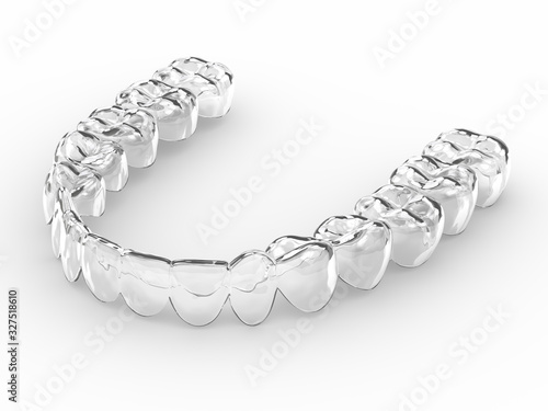 3d render of invisalign removable retainer