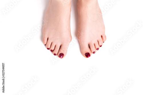 Hallux valgus on female legs on a white background. A bump on female legs close-up. © vfhnb12