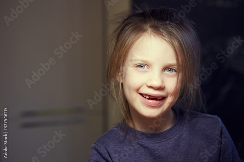 A school-age girl without a front tooths is laughing. Close-up. Change of teeth.