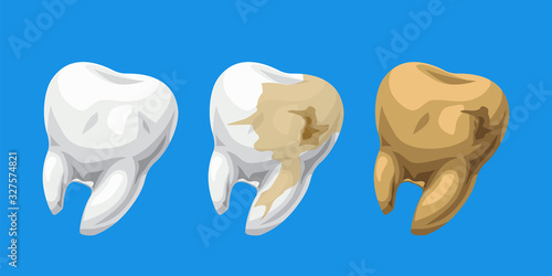 cartoon teeth healthy and caries