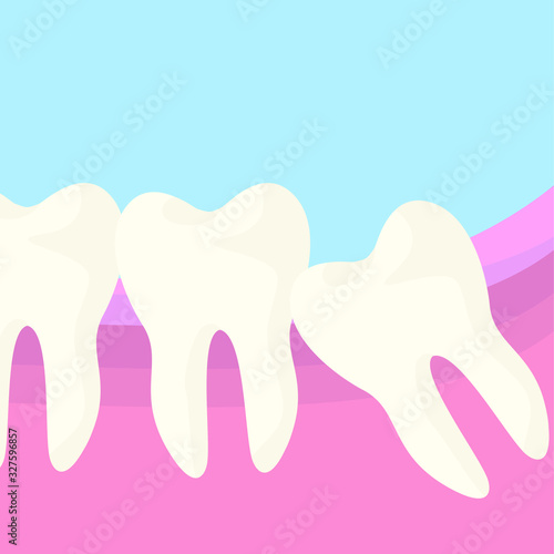 The figure of eight tooth grows incorrectly, the wisdom tooth grows crookedly