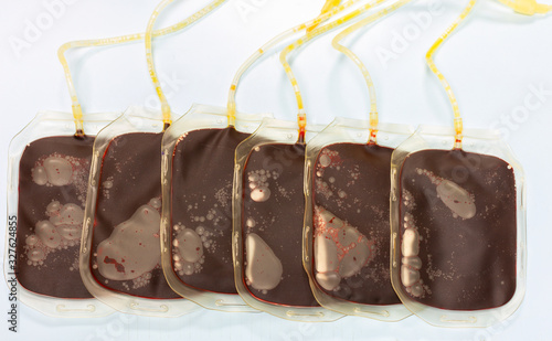 The blood in the blood bag is arranged on a white table.