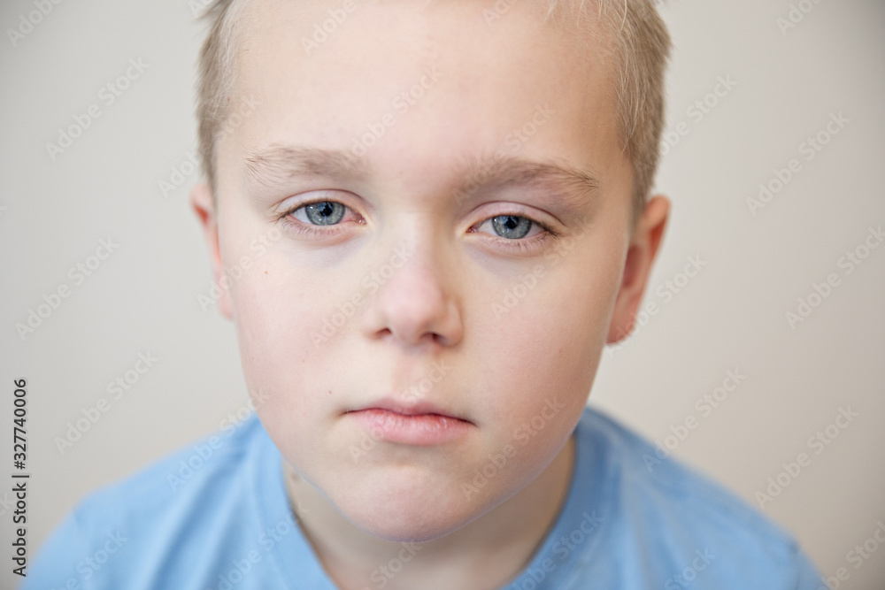 Young boy with either a tired, or sad look on his face Young boy with either a tired, or sad look on his face