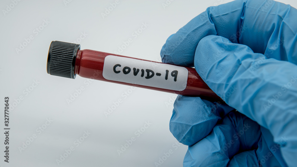 Obraz premium Positive COVID-19 test and laboratory sample blood testing for diagnosis
