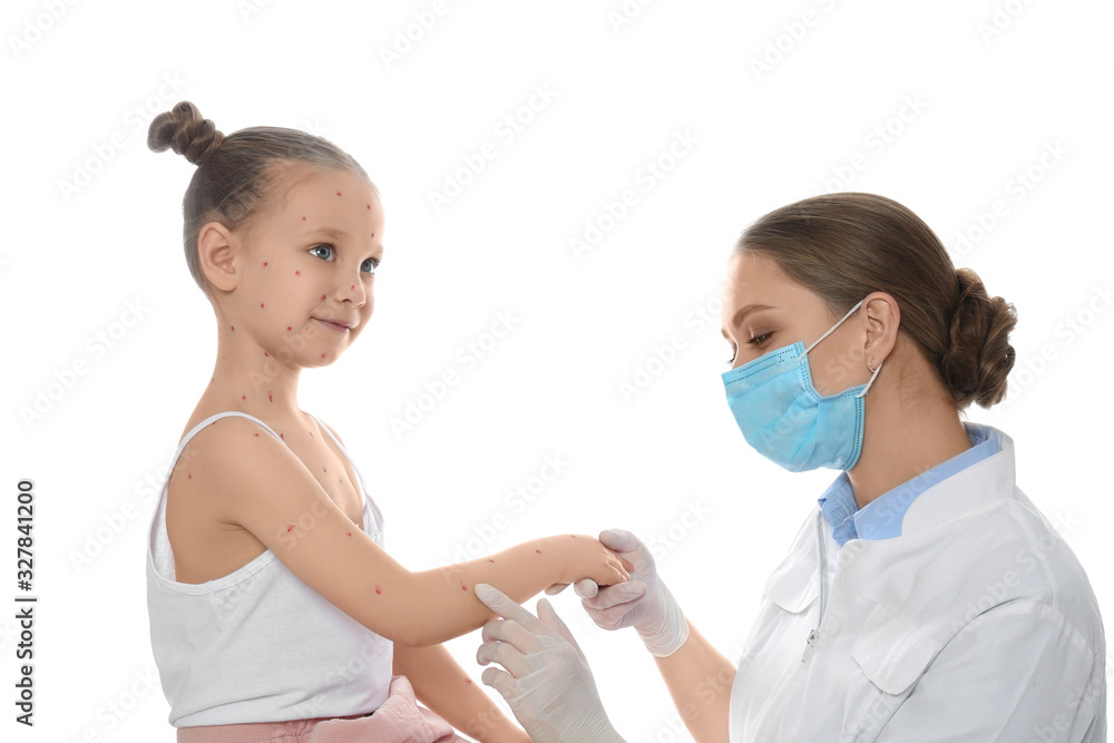 Doctor examining little girl with chickenpox on white background. Varicella zoster virus Doctor examining little girl with chickenpox on white background. Varicella zoster virus