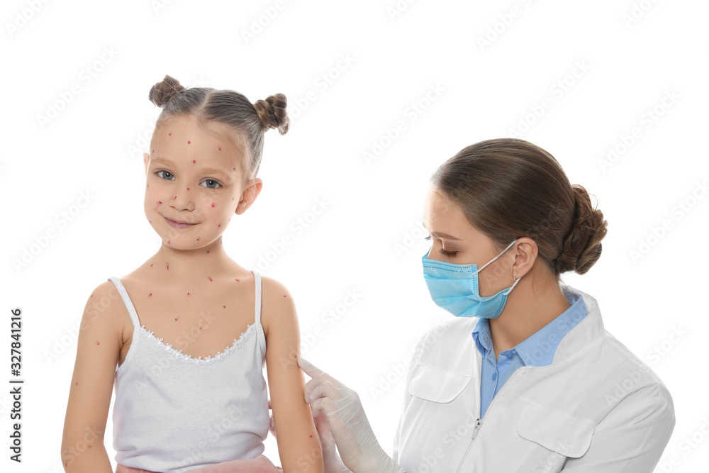 Doctor examining little girl with chickenpox on white background. Varicella zoster virus Doctor examining little girl with chickenpox on white background. Varicella zoster virus