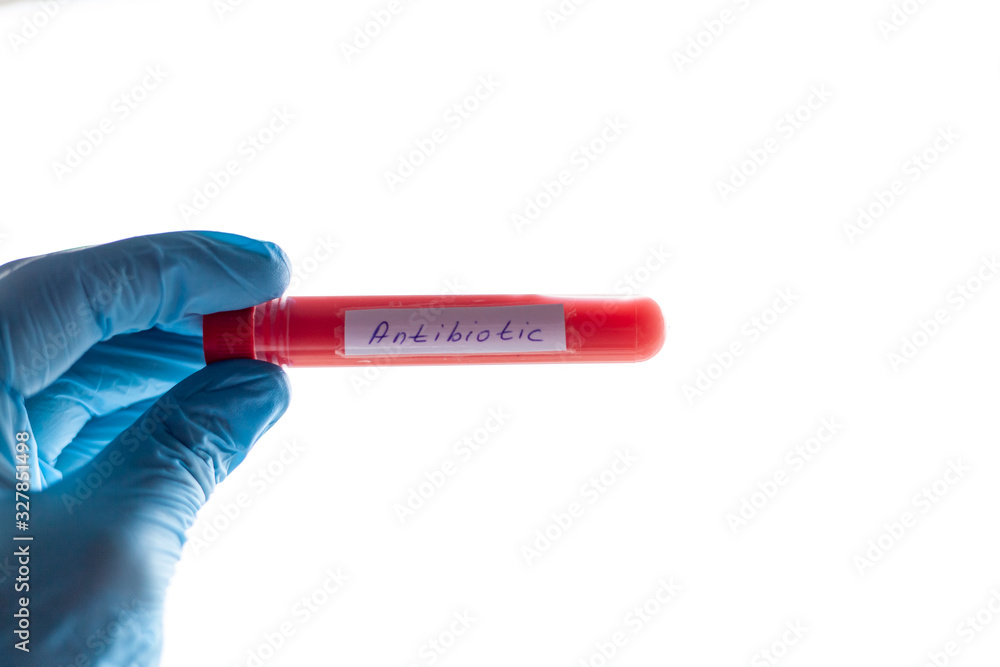 Fototapeta premium test tube in hand, inscription virus, coronavirus study, virus research