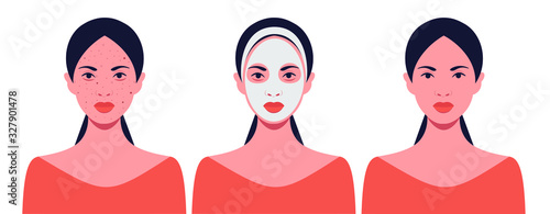 Beautiful woman in the process of cleansing her face from acne. The concept of beauty and health. Vector illustration in flat style.