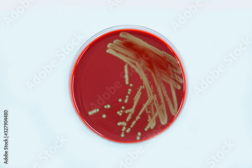Bacteria in culture media on a white background