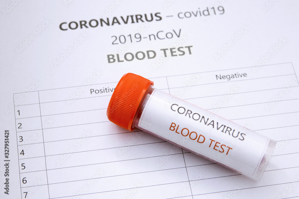 Coronavirus, covid19 - blood test - obrazy, fototapety, plakaty 