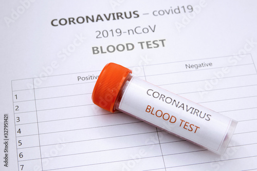 Coronavirus, covid19 - blood test