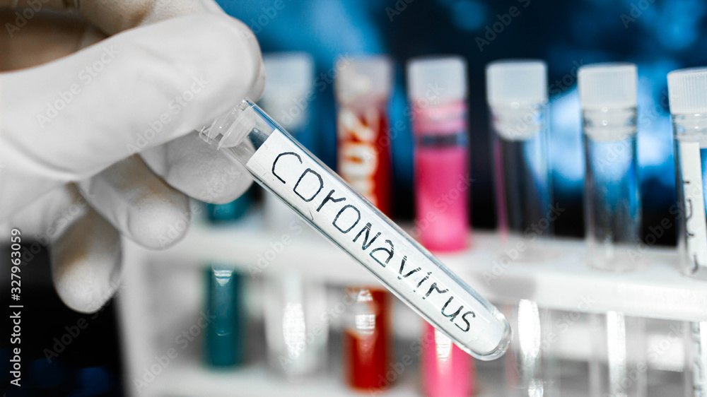 coronavirus study, test tubes with vaccine analyzes. coronavirus study, test tubes with vaccine analyzes.