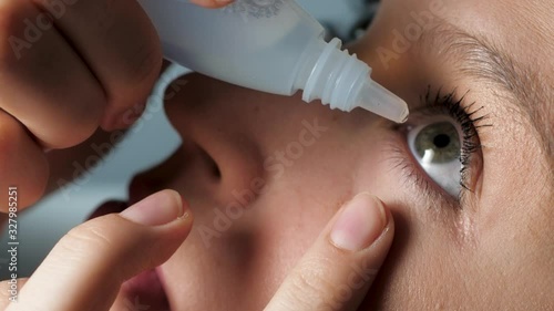 Attractive girl dripping eye drops, introduces them under eyelid into conjunctival sac, looks up with her head thrown back. Glaucoma, cataracts, eye diseases, allergy, conjunctivitis concept