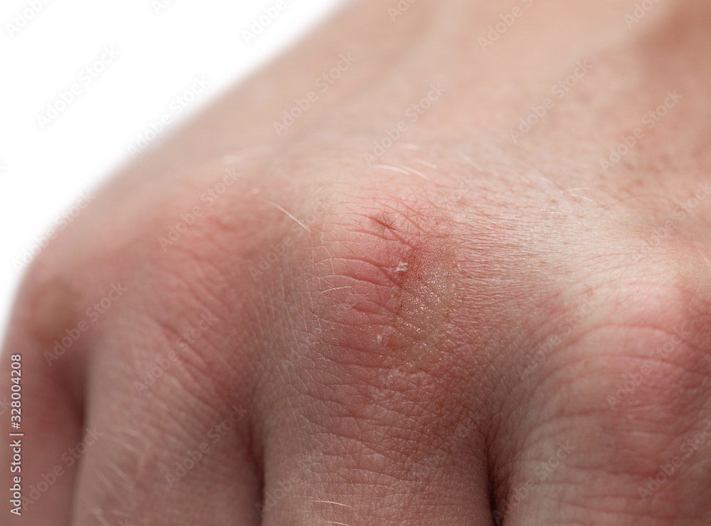 Fototapeta premium worn leather on a man’s hand