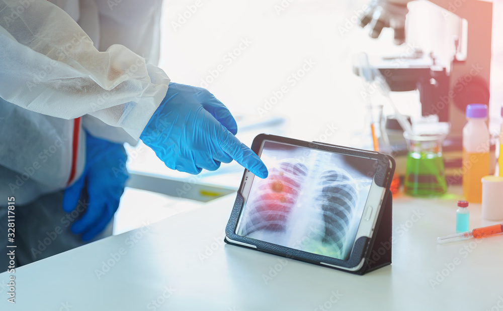 Scientist, Microbiologist or Dotor checking examining viral infection or pneumonia lesion on Chest X-ray film in the laboratory with a biological tube for analysis and sampling of Coronavirus disease 