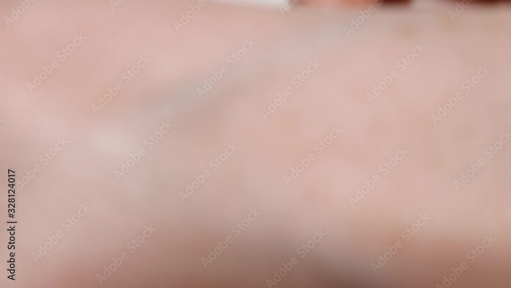 Female hand unsuccessfully tries to stick fresh corn on finger with band-aid Female hand unsuccessfully tries to stick fresh corn on finger with band-aid