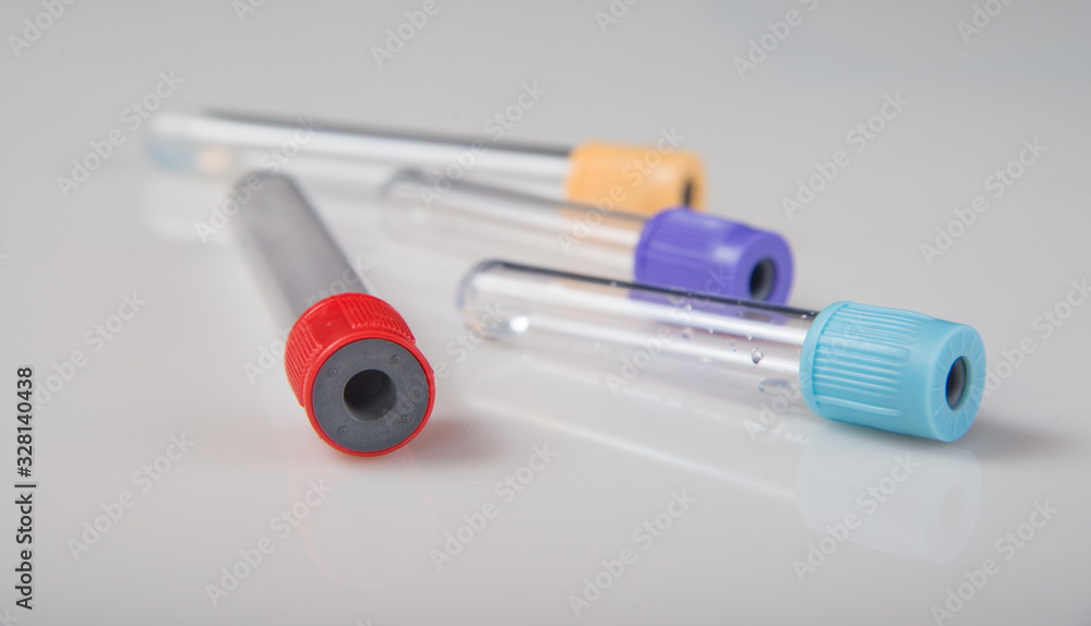 Blood tubes on a light background. The concept of blood testing. Blood tubes on a light background. The concept of blood testing.