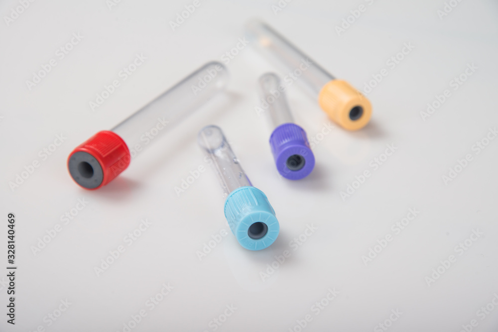 Blood tubes on a light background. The concept of blood testing. Blood tubes on a light background. The concept of blood testing.