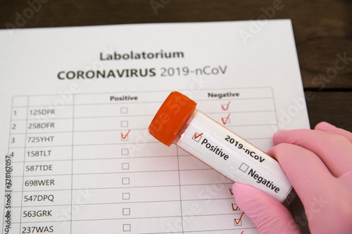 Labolatorium. CORONAVIRUS 2019-nCoV. Wynik pozytywny.
