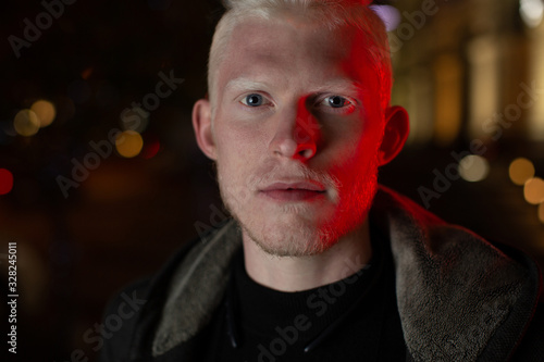 Young albino male looking at the camera photo