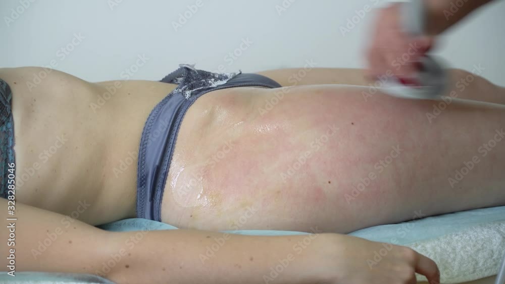 Young woman getting anti-cellulite and anti-fat therapy in beauty salon. Body care. Hardware cosmetology Young woman getting anti-cellulite and anti-fat therapy in beauty salon. Body care. Hardware cosmetology