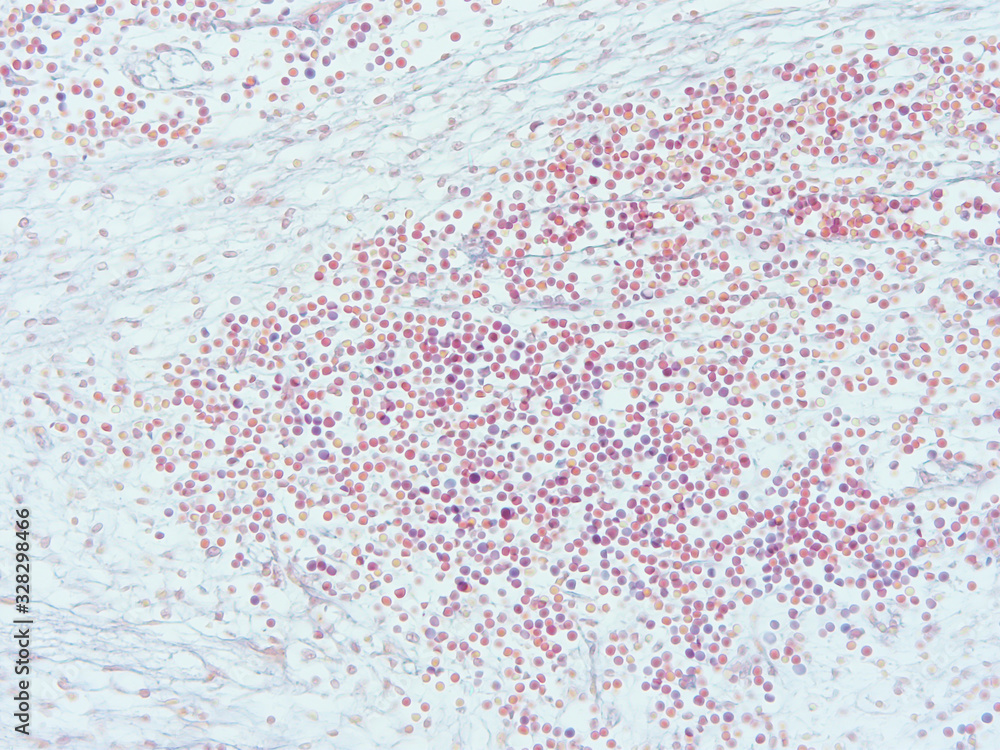 picture of histology human tissue with microscope from laboratory (not Illustration Designation) picture of histology human tissue with microscope from laboratory (not Illustration Designation)