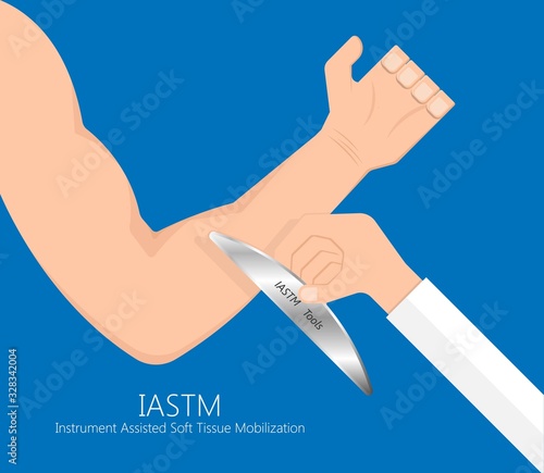 Instrument Assisted Soft Tissue Mobilization IASTM treat injury illness rehab body fascia muscle clinical inflammatory