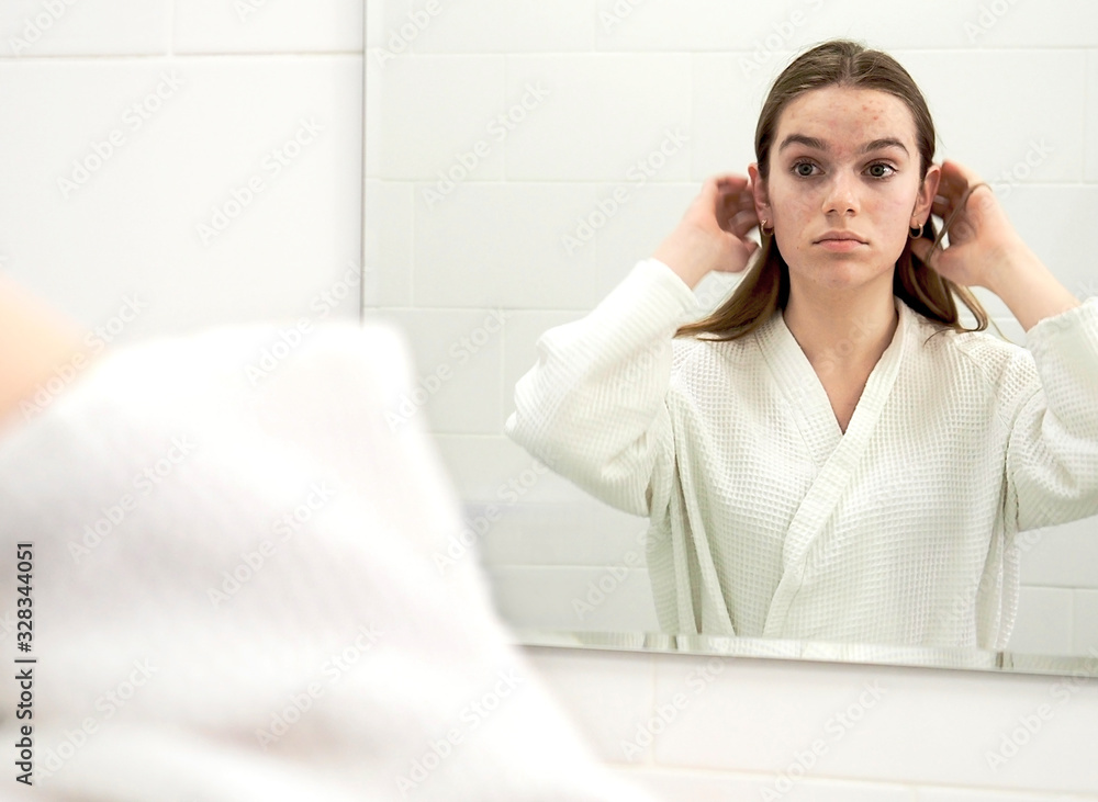 Sleepy young woman, reflection in the mirror, girl is upset because of the severe acne looks in the mirror Sleepy young woman, reflection in the mirror, girl is upset because of the severe acne looks in the mirror
