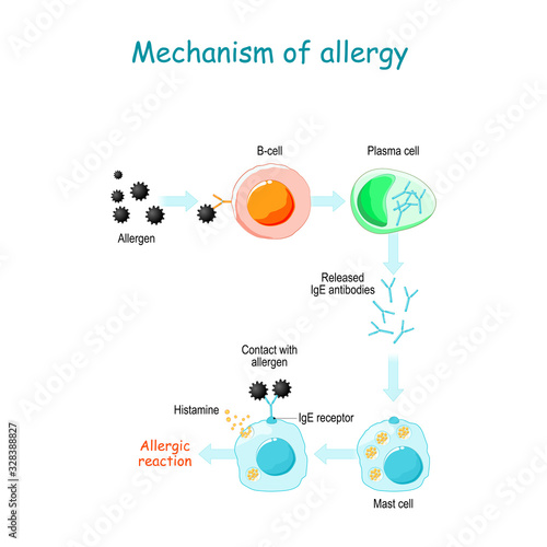 Mechanism of allergy.