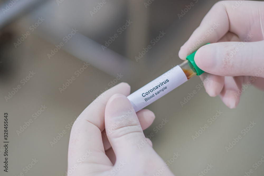 Fototapeta premium Asian male doctor holding Covid-19 Blood Sample on White Background