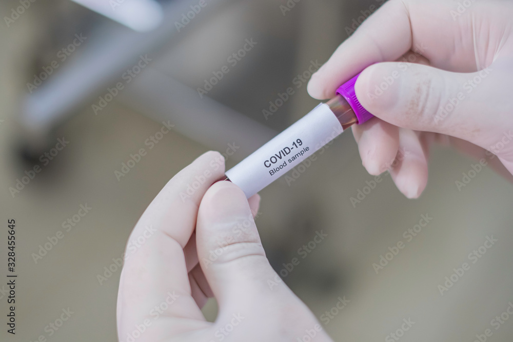 Fototapeta premium Asian male doctor holding Covid-19 Blood Sample on White Background